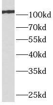 Western Blot mGluR4 Antibody - BSA Free