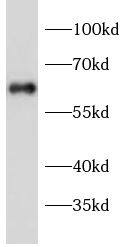 Western Blot: Collagen X alpha 1 Antibody - BSA Free [NBP3-47475] - Rat testis were subjected to SDS PAGE followed by western blot with (Collagen X alpha 1 antibody) at dilution of 1:1000