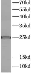 Western Blot LMO1 Antibody - BSA Free
