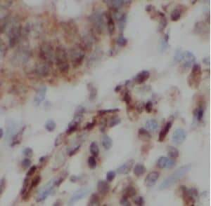 Immunohistochemistry LMO1 Antibody - BSA Free