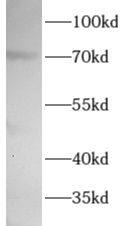 Western Blot: Wee1 Antibody - BSA Free [NBP3-47479] - Jurkat cells were subjected to SDS PAGE followed by western blot with ( Wee1 Antibody) at dilution of 1:1000