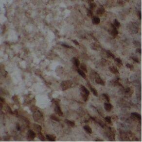 Immunohistochemistry: Wee1 Antibody - BSA Free [NBP3-47479] - Immunohistochemistry of paraffin-embedded rat testis tissue slide using (Wee1 Antibody) at dilution of 1:200