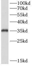 Western Blot: Thymidine Kinase 2 Antibody - BSA Free [NBP3-47480] - Mouse liver were subjected to SDS PAGE followed by western blot with (Thymidine Kinase 2 antibody) at dilution of 1:1000