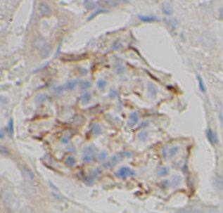 Immunohistochemistry: Thymidine Kinase 2 Antibody - BSA Free [NBP3-47480] - Immunohistochemistry of paraffin-embedded rat kidney tissue slide using (Thymidine Kinase 2 Antibody) at dilution of 1:100