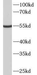 Western Blot: METTL4 Antibody - BSA Free [NBP3-47485] - A549 cells were subjected to SDS PAGE followed by western blot with (METTL4 Antibody) at dilution of 1:1000