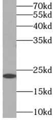 Western Blot: Myosin light chain 3 Antibody - BSA Free [NBP3-47487] - HepG2 cells were subjected to SDS PAGE followed by western blot with (Myosin light chain 3 antibody) at dilution of 1:1000