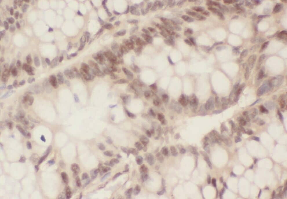 Immunohistochemistry ZWILCH Antibody - BSA Free