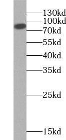 Western Blot: NY-REN-50 antigen Antibody - BSA Free [NBP3-47502] - HeLa cells were subjected to SDS PAGE followed by western blot with (NY-REN-50 antigen antibody) at dilution of 1:500