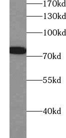 Western Blot: ZNF750 Antibody - BSA Free [NBP3-47505] - Mouse thymus tissue were subjected to SDS PAGE followed by western blot with (ZNF750 antibody) at dilution of 1:500