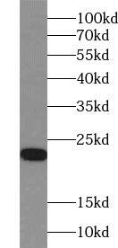 Western Blot: ZNF747 Antibody - BSA Free [NBP3-47506] - PC-3 cells were subjected to SDS PAGE followed by western blot with (ZNF747 Antibody) at dilution of 1:600