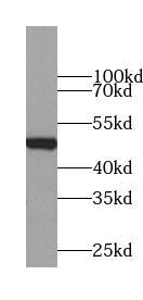 Western Blot: ZNF689 Antibody - BSA Free [NBP3-47510] - HeLa cells were subjected to SDS PAGE followed by western blot with (ZNF689 Antibody) at dilution of 1:600