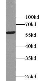 Western Blot: ZNF649 Antibody - BSA Free [NBP3-47513] - HL-60 cells were subjected to SDS PAGE followed by western blot with (ZNF649 Antibody) at dilution of 1:300