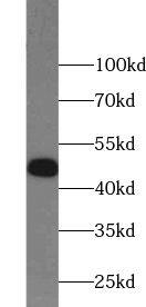 Western Blot: ZNF645 Antibody - BSA Free [NBP3-47514] - Human testis tissue were subjected to SDS PAGE followed by western blot with (ZNF645 Antibody) at dilution of 1:1000