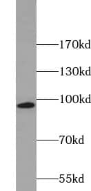 Western Blot ZNF606 Antibody - BSA Free