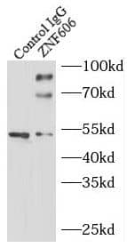 Immunoprecipitation ZNF606 Antibody - BSA Free