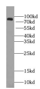 Western Blot: ZNF600 Antibody - BSA Free [NBP3-47517] - Mouse kidney tissue were subjected to SDS PAGE followed by western blot with (ZNF600 Antibody) at dilution of 1:300