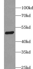Western Blot ZNF597 Antibody - BSA Free