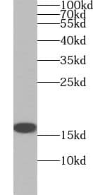 Western Blot: ZNF593 Antibody - BSA Free [NBP3-47520] - Mouse spleen tissue were subjected to SDS PAGE followed by western blot with (ZNF593 antibody) at dilution of 1:200