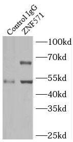Immunoprecipitation: ZNF571 Antibody - BSA Free [NBP3-47521] - IP Result of anti-ZNF571 (IP:, 4ug; Detection: 1:300) with MCF-7 cells lysate 1200ug.