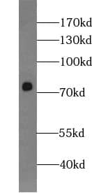 Western Blot: ZNF549 Antibody - BSA Free [NBP3-47523] - SH-SY5Y cells were subjected to SDS PAGE followed by western blot with (ZNF549 Antibody) at dilution of 1:600