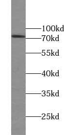 Western Blot: FLJ13946 Antibody - BSA Free [NBP3-47524] - Rat testis tissue were subjected to SDS PAGE followed by western blot with (FLJ13946 Antibody) at dilution of 1:1000