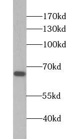 Western Blot ZNF512 Antibody - BSA Free