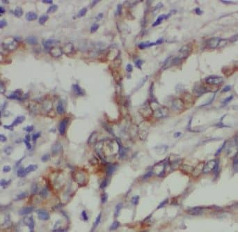 Immunohistochemistry CPNE8 Antibody - BSA Free