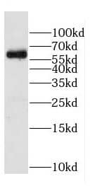 Western Blot Copine-6 Antibody - BSA Free