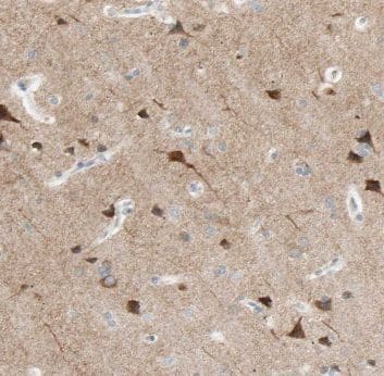 Immunohistochemistry CPLX4 Antibody - BSA Free