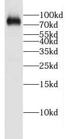 Western Blot: CPEB4 Antibody - BSA Free [NBP3-47533] - SH-SY5Y cells were subjected to SDS PAGE followed by western blot with ( CPEB4 Antibody) at dilution of 1:600