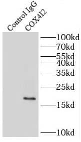 Immunoprecipitation: COX IV Isoform 2 Antibody - BSA Free [NBP3-47540] - IP Result of anti-COX IV Isoform 2 (IP:, 3ug; Detection: 1:1000) with HepG2 cells lysate 8000ug.