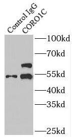 Immunoprecipitation: Coronin 3 Antibody - BSA Free [NBP3-47547] - IP Result of anti-Coronin 3 (IP:, 4ug; Detection: 1:500) with mouse skeletal muscle tissue lysate 3600ug.