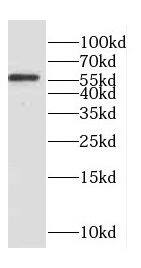 Western Blot: Coronin 3 Antibody - BSA Free [NBP3-47547] - Mouse skeletal muscle tissue were subjected to SDS PAGE followed by western blot with (Coronin 3 antibody) at dilution of 1:500