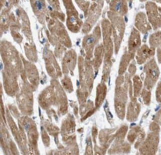 Immunohistochemistry COQ6 Antibody - BSA Free