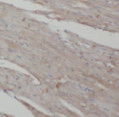 Immunohistochemistry: COPG2 Antibody - BSA Free [NBP3-47555] - Immunohistochemistry of paraffin-embedded human heart using (COPG2 antibody) at dilution of 1:50