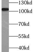 Western Blot: COP1 Antibody - BSA Free [NBP3-47557] - MCF7 cells were subjected to SDS PAGE followed by western blot with (COP1 antibody) at dilution of 1:1000