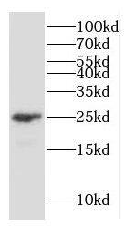 Western Blot Connexin 26/GJB2 Antibody - BSA Free