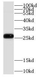 Western Blot: COMMD5 Antibody - BSA Free [NBP3-47560] - Mouse kidney tissue were subjected to SDS PAGE followed by western blot with (COMMD5 antibody) at dilution of 1:1000