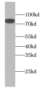 Western Blot: Collagen VIII alpha 1 Antibody - BSA Free [NBP3-47562] - HepG2 cells were subjected to SDS PAGE followed by western blot with (Collagen VIII alpha 1 antibody) at dilution of 1:500