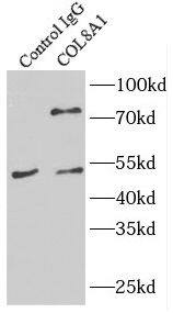 Immunoprecipitation: Collagen VIII alpha 1 Antibody - BSA Free [NBP3-47562] - IP Result of anti-Collagen VIII alpha 1 (IP:, 4ug; Detection: 1:500) with HepG2 cells lysate 1800ug.