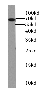Western Blot: COG8 Antibody - BSA Free [NBP3-47564] - HeLa cells were subjected to SDS PAGE followed by western blot with (COG8 antibody) at dilution of 1:400