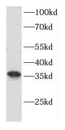 Western Blot: CNTD Antibody - BSA Free [NBP3-47567] - Mouse colon tissue were subjected to SDS PAGE followed by western blot with ( CNTD Antibody) at dilution of 1:600