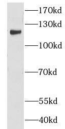 Western Blot: CNOT3 Antibody - BSA Free [NBP3-47569] - Raji cells were subjected to SDS PAGE followed by western blot with (CNOT3 antibody) at dilution of 1:500