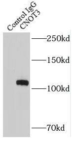 Immunoprecipitation: CNOT3 Antibody - BSA Free [NBP3-47569] - IP Result of anti-CNOT3 (IP:, 4ug; Detection: 1:1000) with HeLa cells lysate 3200ug.