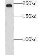 Western Blot CNOT1 Antibody - BSA Free