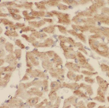 Immunohistochemistry CNOT1 Antibody - BSA Free