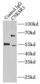 Immunoprecipitation: CNKSR3 Antibody - BSA Free [NBP3-47571] - IP Result of anti-CNKSR3 (IP:, 4ug; Detection: 1:500) with mouse brain tissue lysate 3440ug.
