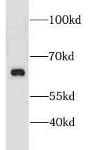 Western Blot: CNKSR3 Antibody - BSA Free [NBP3-47571] - Human brain tissue were subjected to SDS PAGE followed by western blot with (CNKSR3 antibody) at dilution of 1:600