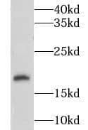 Western Blot: CNIH3 Antibody - BSA Free [NBP3-47572] - SK-BR-3 cells were subjected to SDS PAGE followed by western blot with (CNIH3 antibody) at dilution of 1:500