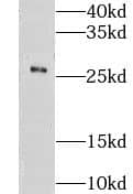 Western Blot Cklfsf8 Antibody - BSA Free